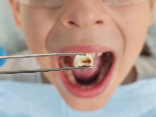 Best Pediatric Emergency Dentist in Forest City, FL